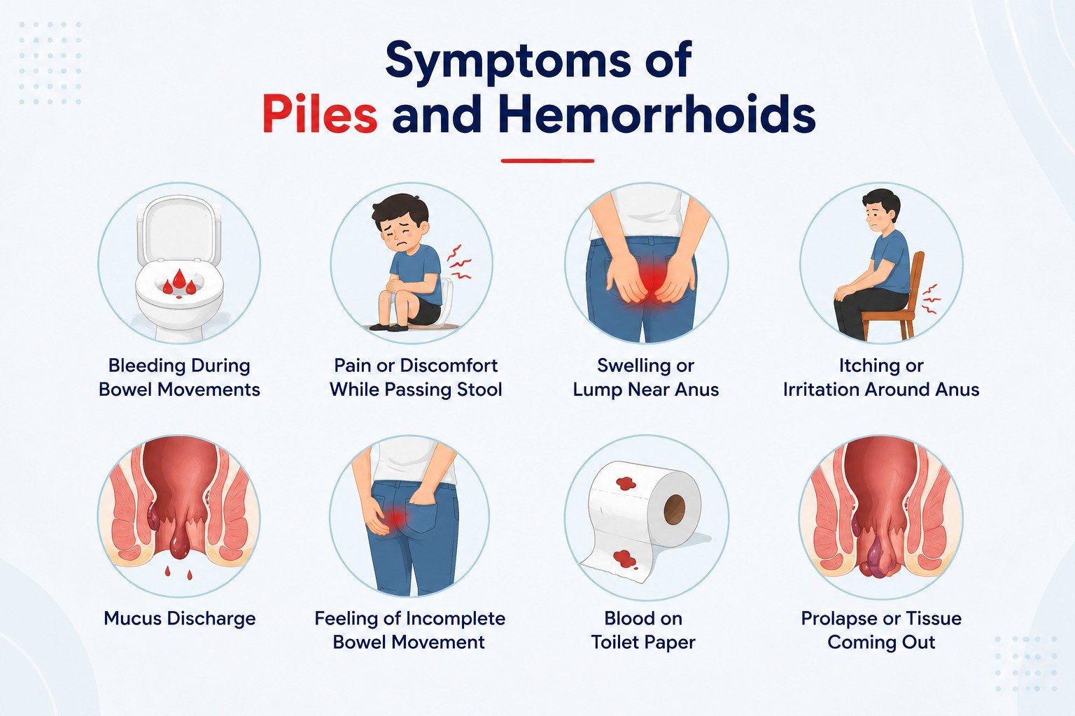Symptoms of piles and hemorrhoids